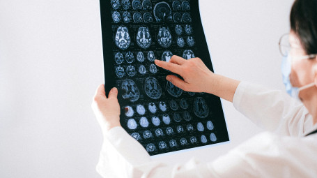 Neurologian poliklinikka - Yksikön esittely opiskelijoille