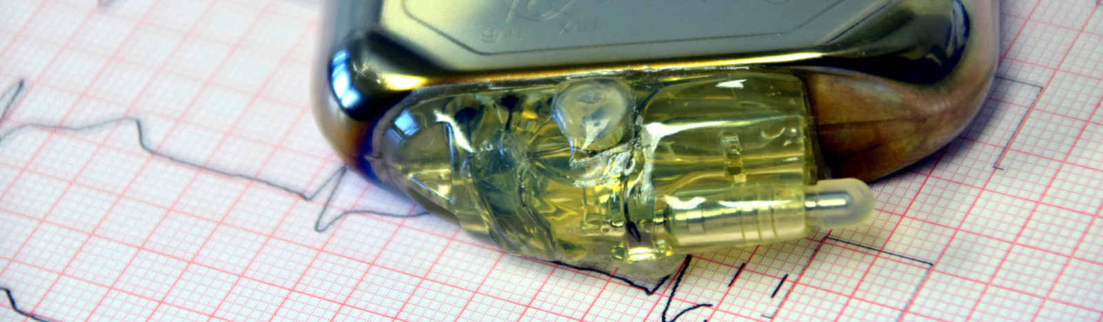Sisätautien, keuhkosairauksien ja neurologian osasto A, kerros 5, pohjois- ja eteläpääty