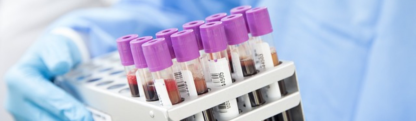 Omasote laboratoriotulokset